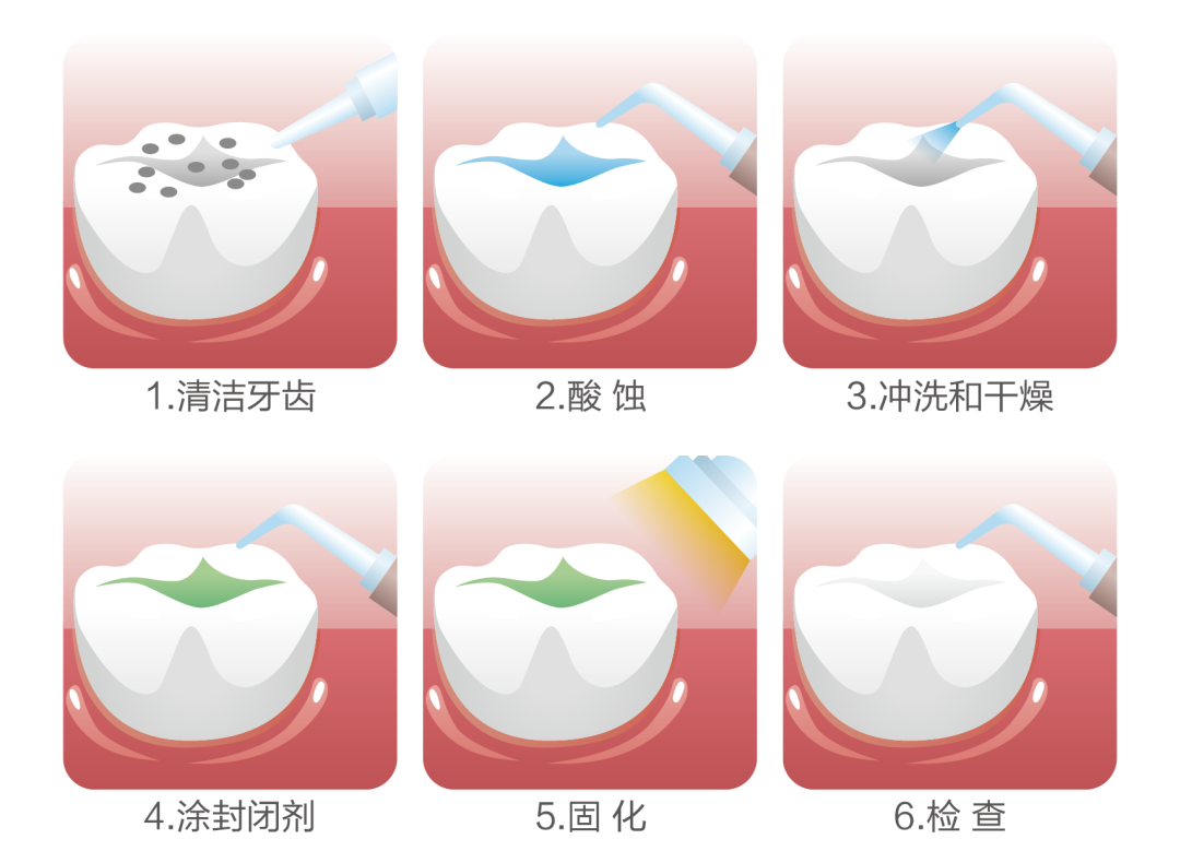 576ec0bfc04df56d0c4d2ae9f7d506e.png